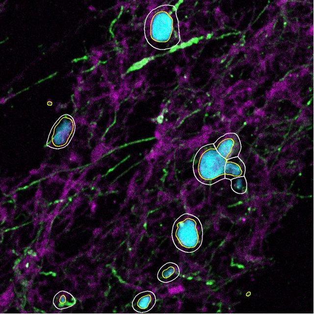 Cell and nucleus outlines on nuclei, GFAP and phalloidin