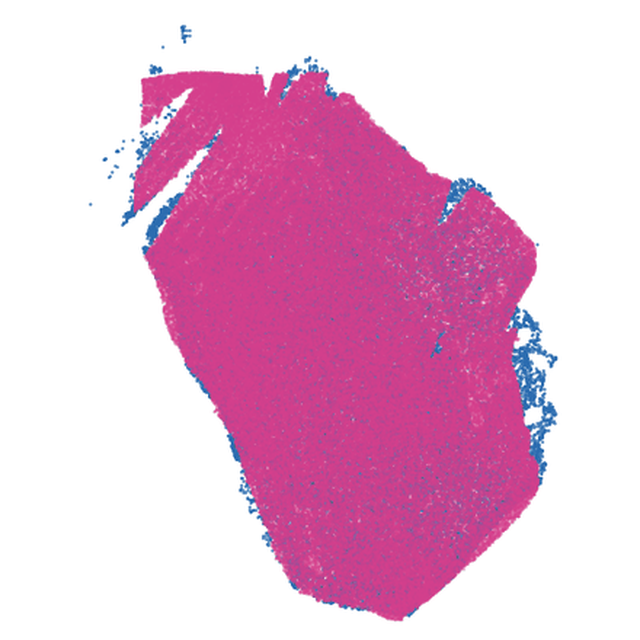 MALDI pixels registered onto Xenium cells