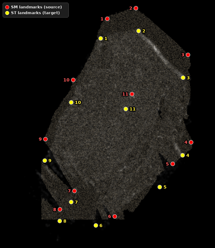 Eleven landmark pairs numbered in click order