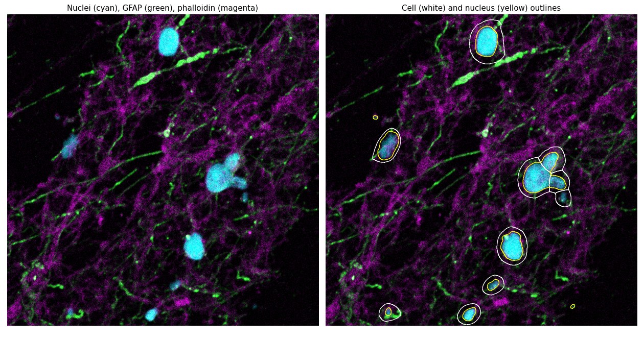 Nuclei, GFAP and phalloidin with cell and nucleus outlines