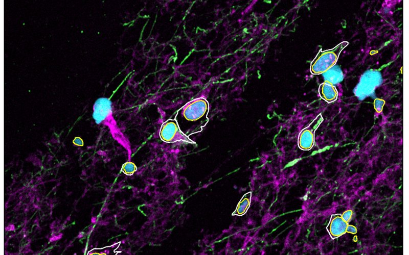 Nuclei, GFAP and phalloidin with cell and nucleus outlines